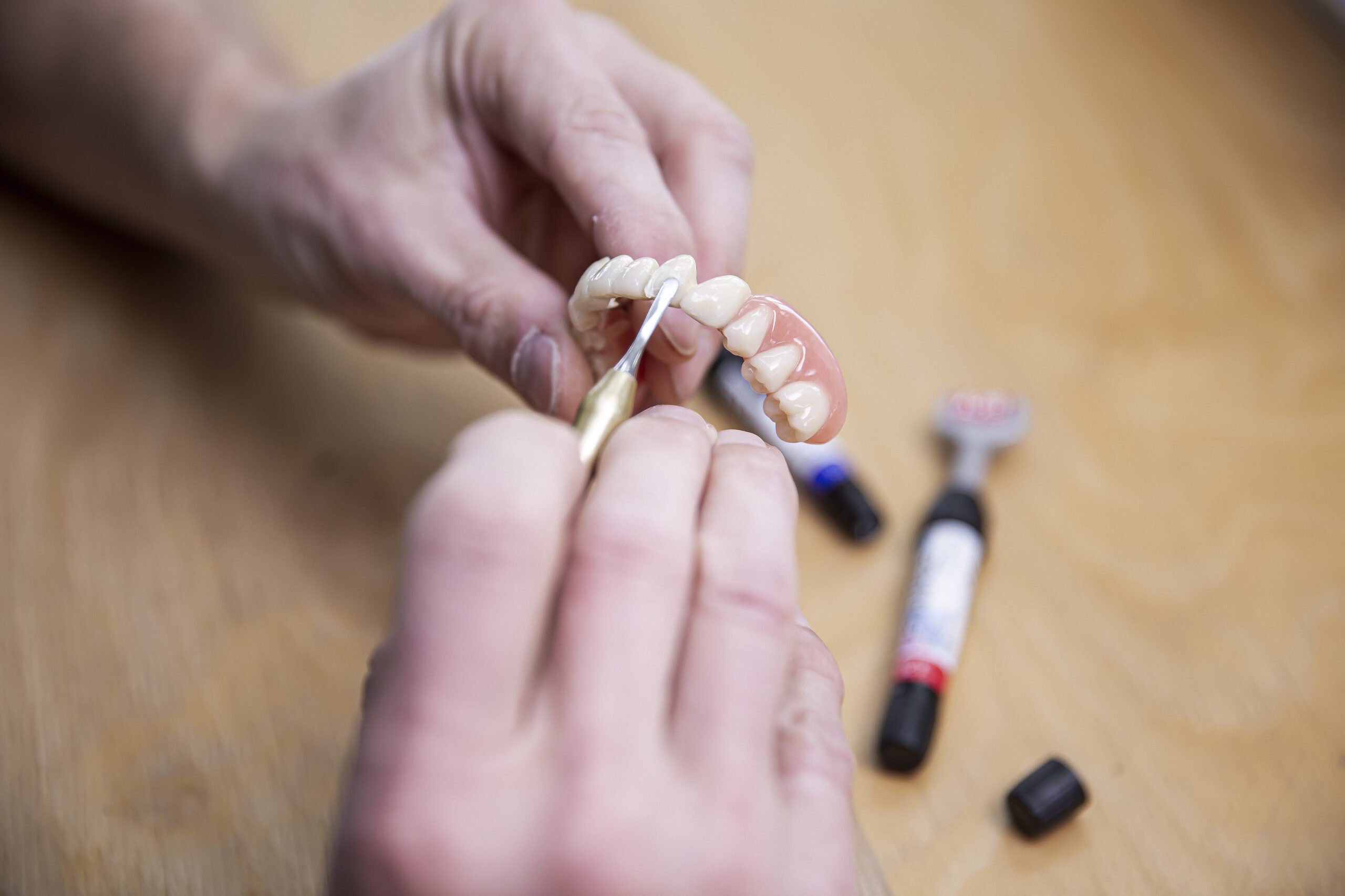 Kunststoffverblendung